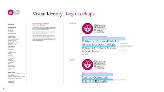 University of Galway