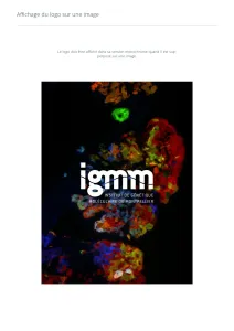 Igmm